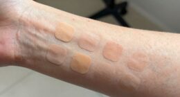 pre application skin test