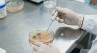 CDC seeks source of parasitic outbreak linked to ‘explosive’ diarrhea in multiple states