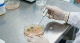 CDC seeks source of parasitic outbreak linked to ‘explosive’ diarrhea in multiple states